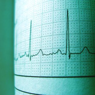 Cuidado cardio vascular